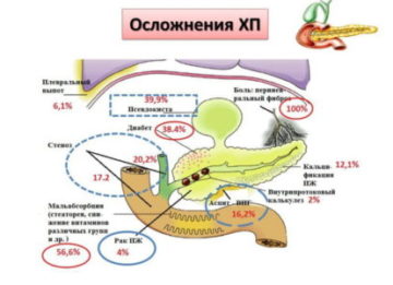 Сколько живут с панкреатитом?